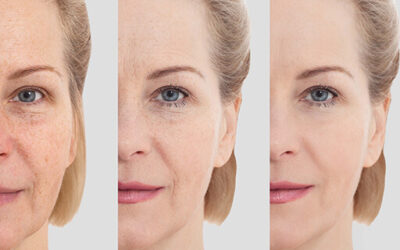 Skin Rejuvenation for Every Age: Best Treatments in Your 20s, 30s, 40s, and Beyond