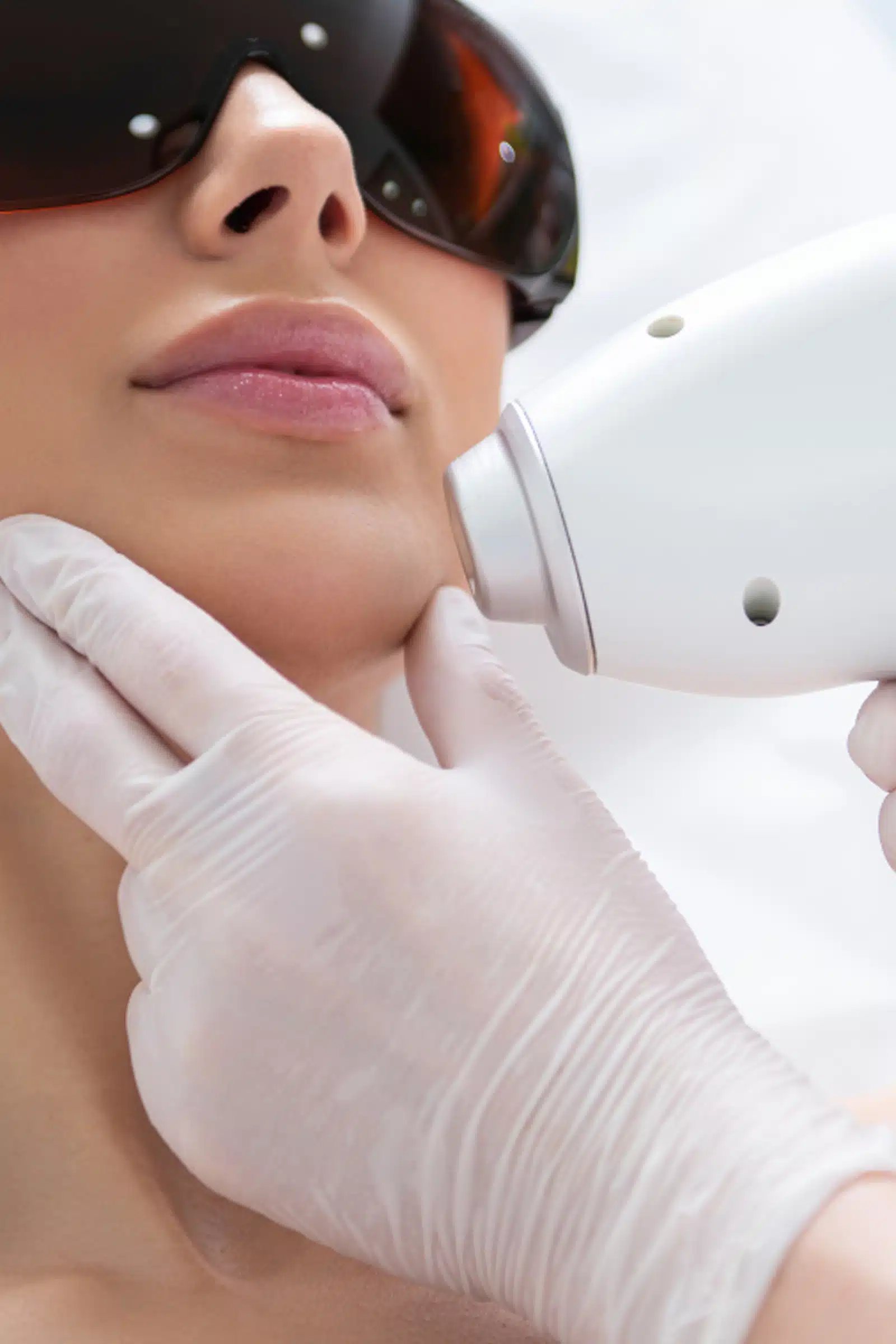 Laser Hair Removal Laser Hair Removal