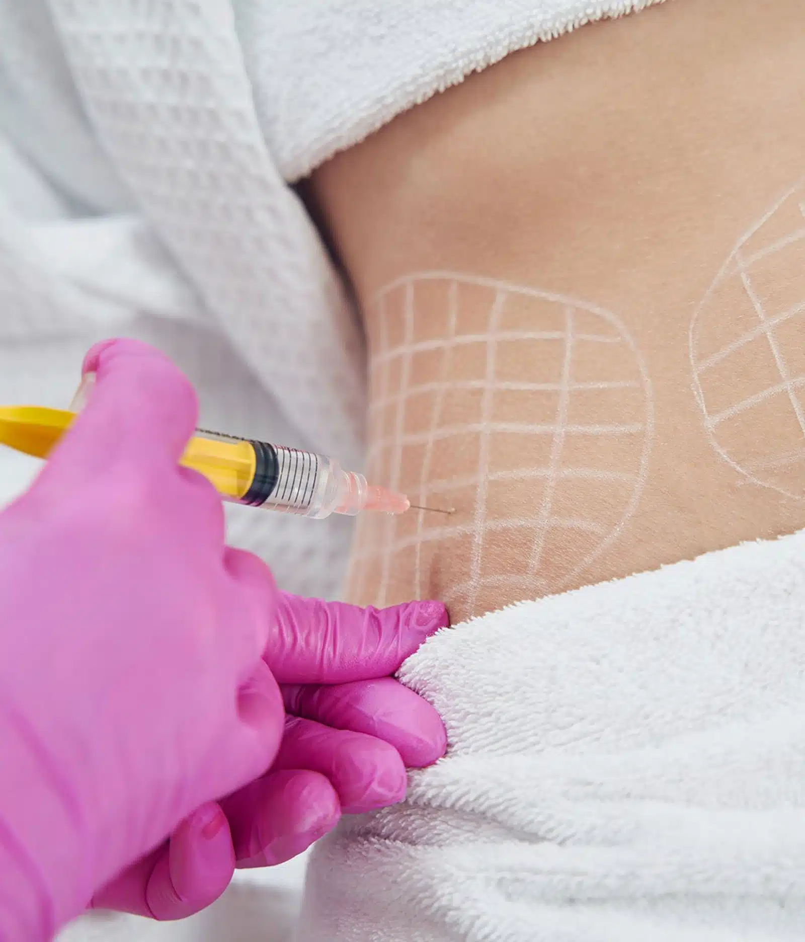 Personalized weight loss