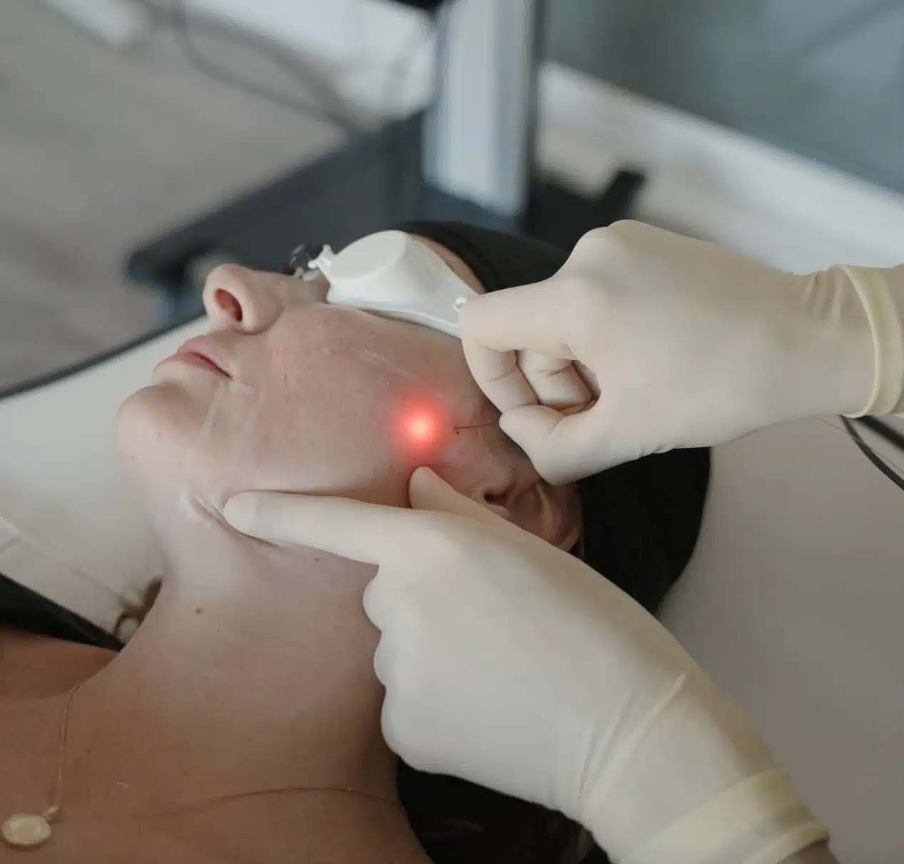 Laser Skin Tightening