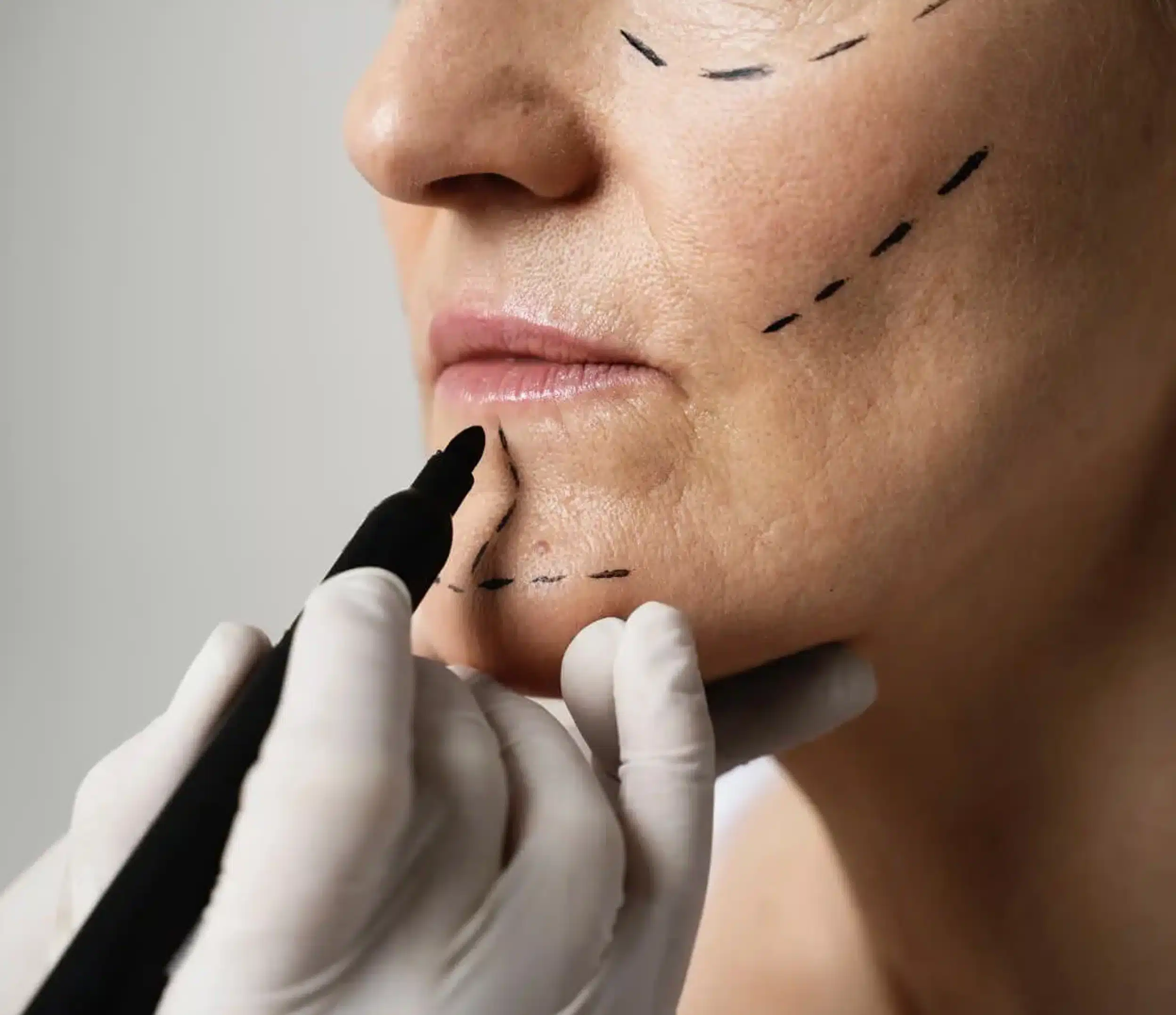biostimulators