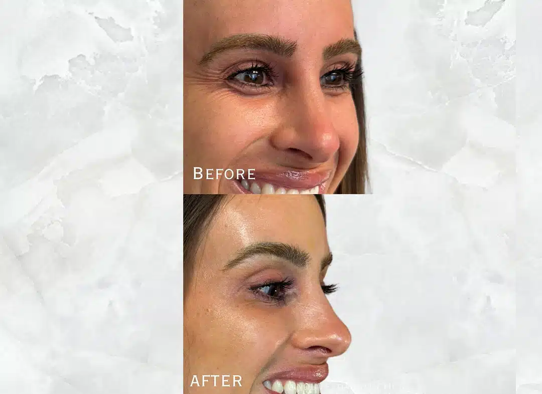 Toxin Refresh your look 