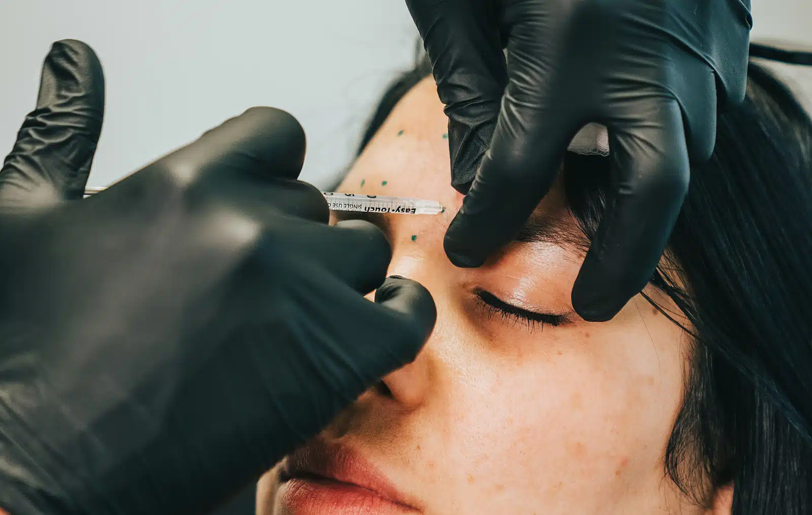 PRP Face Injection